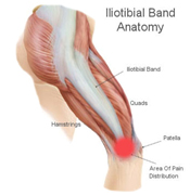 ITBS- Illiotibial band Syndrome